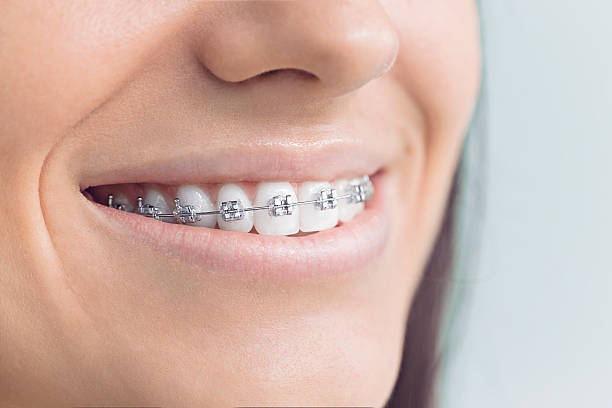 Best Traditional Braces  in Jeffersonville, IN
